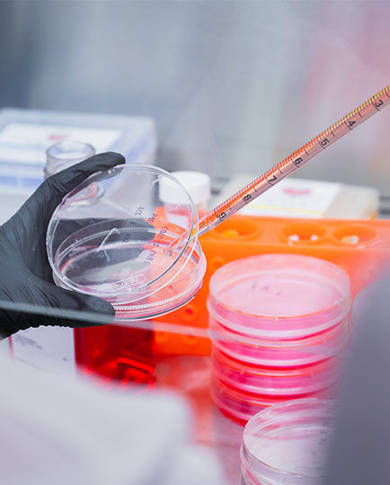 Medial professional putting a sample in a petri dish in a lab